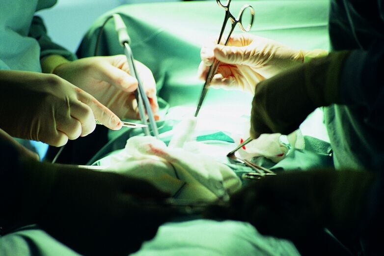 chirurgické zvýšenie hrúbky penisu